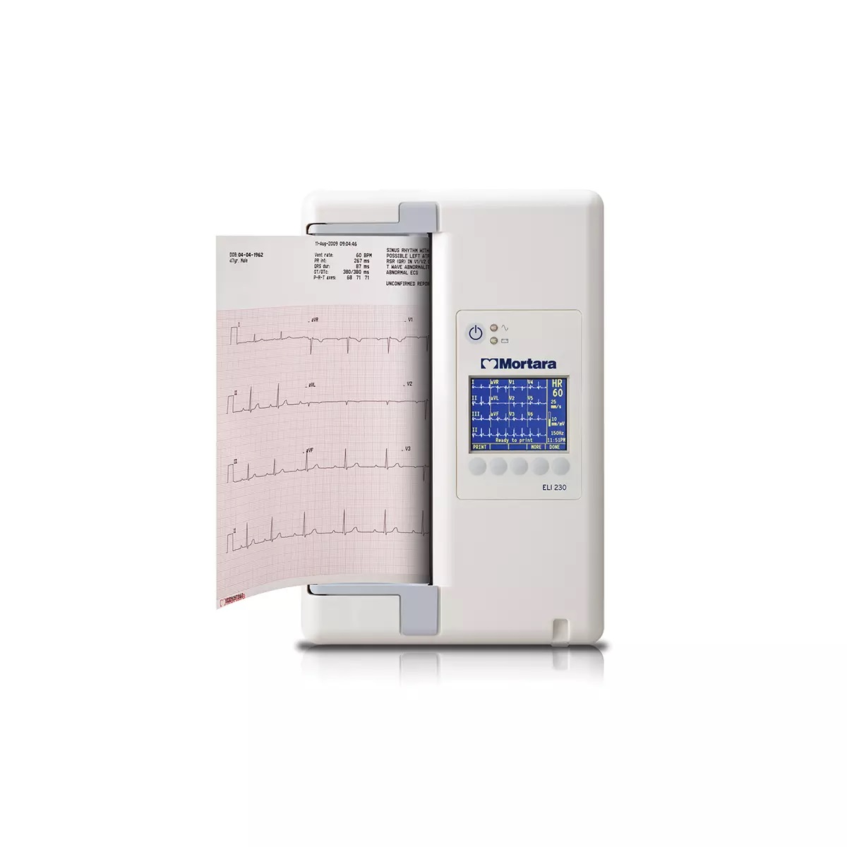 Electrocardiograph, Resting, ELI 230, Color Display, AM12, ECG Clip Adapters, Electrodes, 20 Patient Storage, Thermal Roll (1/EA) by Hillrom/Welch Allyn  ID BUR230-A